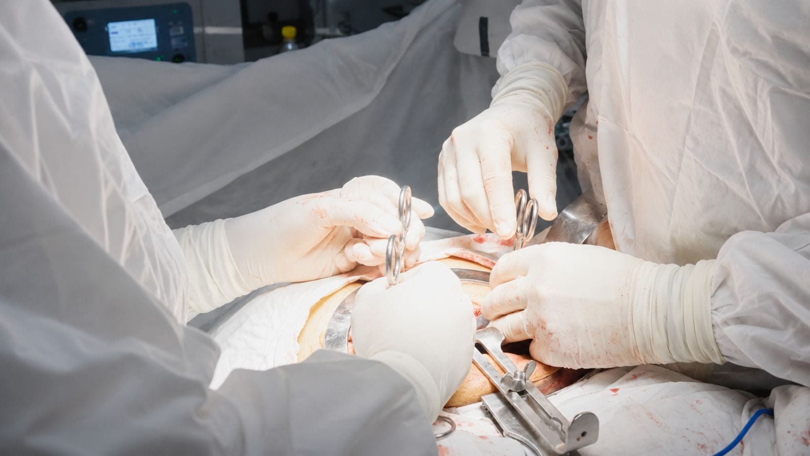 Equipo médico liderado por el Dr. Luis Zamora